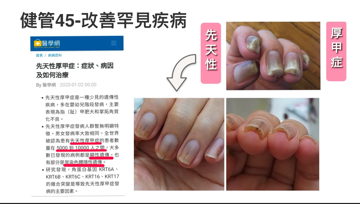 慧 1